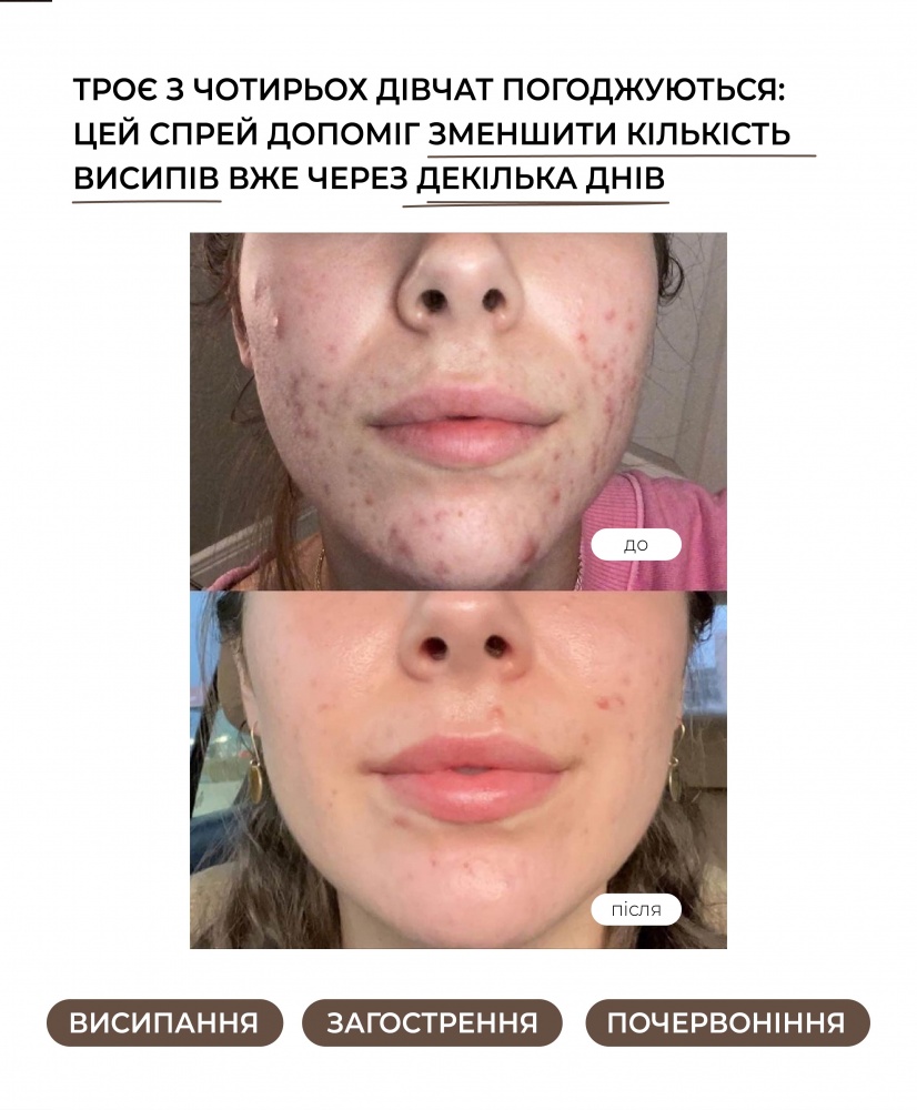  SOS-  , 50 