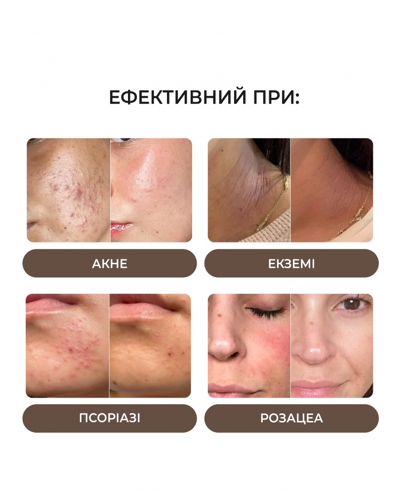  SOS-  , 50 