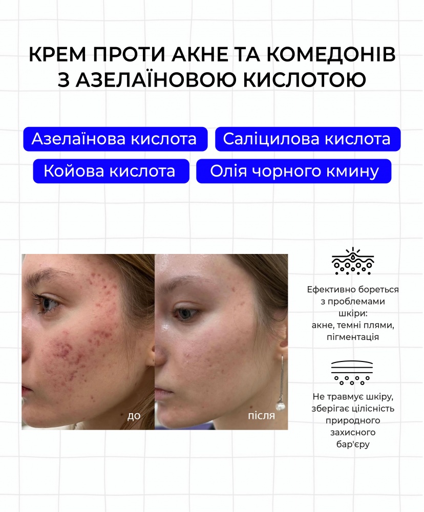        , 30 