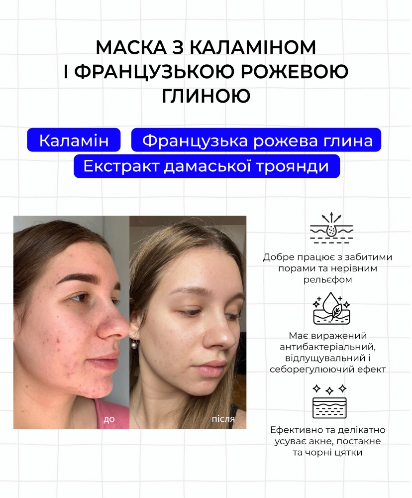       , 100 