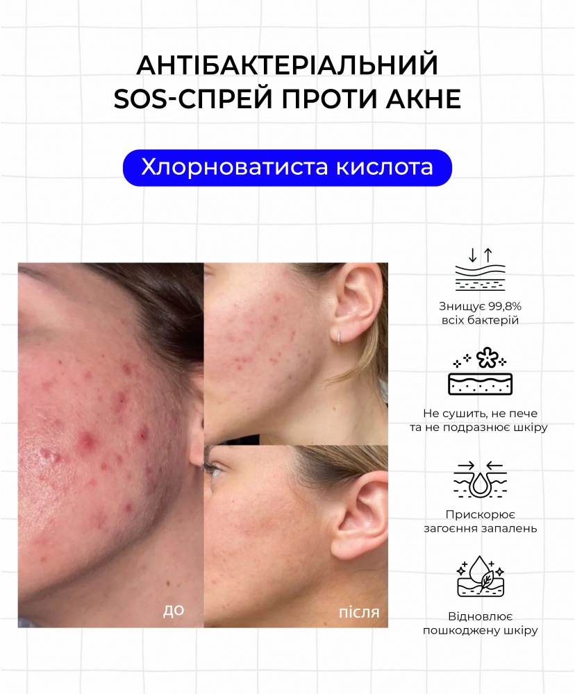  SOS-  , 50 