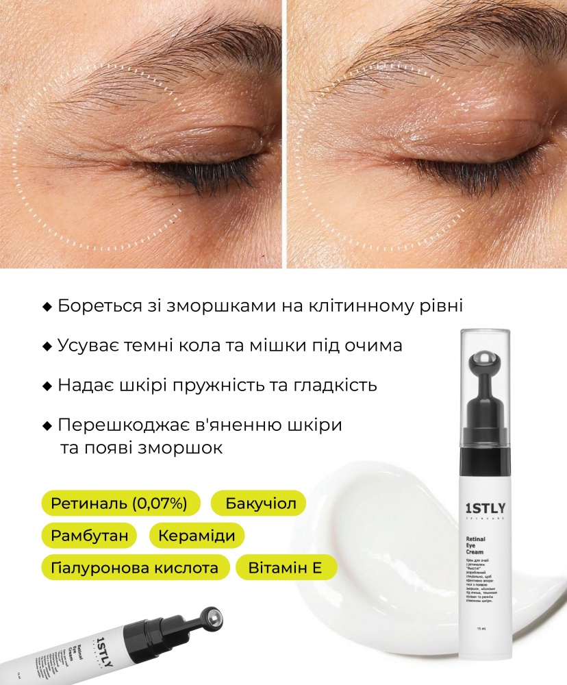 ���� ��� ���� ������� ���� � ��������� �� ����������, 15 ��