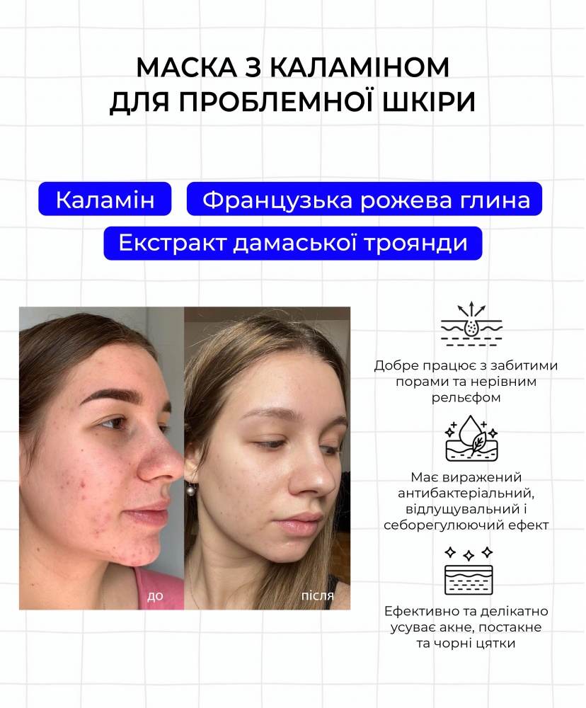      , 100 